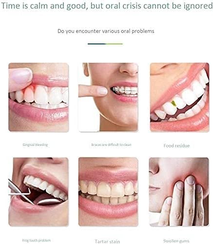 SMSOM bežični zubni flosser, prijenosni zubni oralni irigator, punjivi čistač zuba, IPX7 vodootporan, 400ml