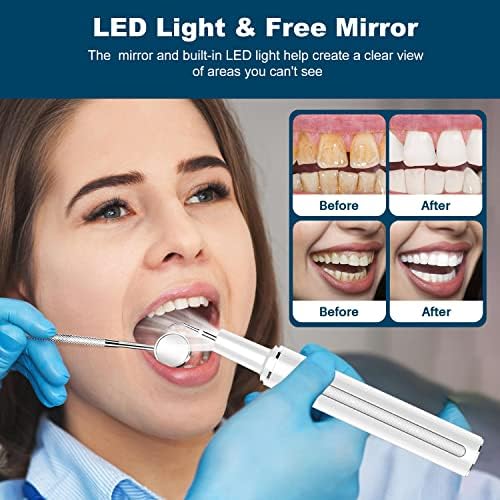 Kit za čišćenje zuba, električni alat za čišćenje zuba sa LED svjetlom, sredstvo za čišćenje zuba sa 3 načina,