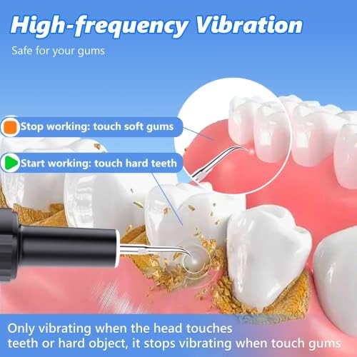Električni komplet za čišćenje zuba - 4 načina uklanjanja plaka za uklanjanje zuba, zubne alate za čišćenje